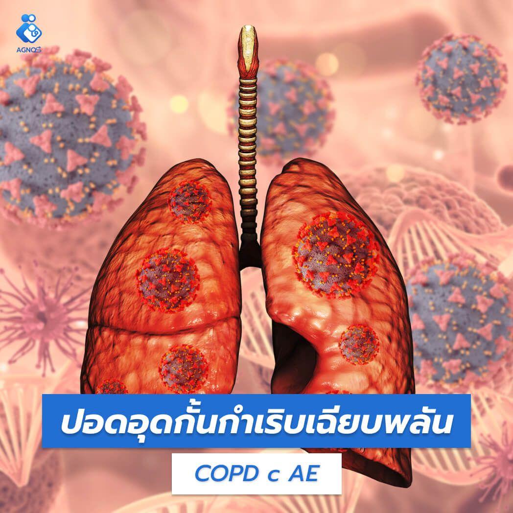 article-cover